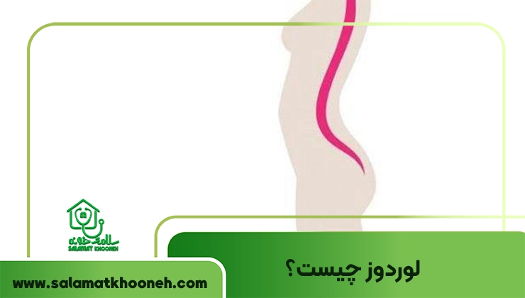 لوردوز