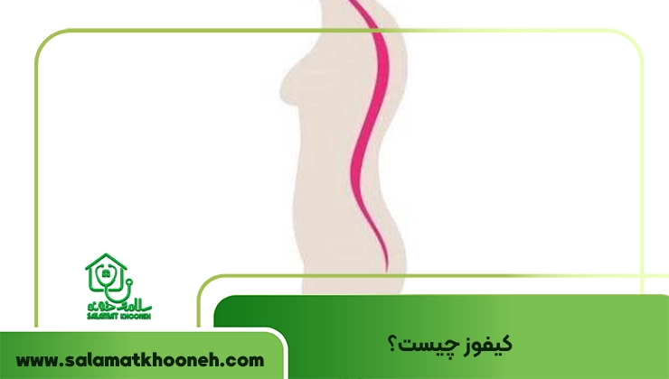 کیفوز