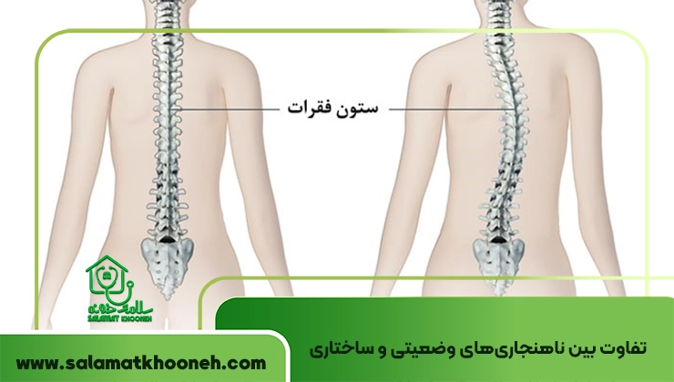 Sixty vertebrae deviations