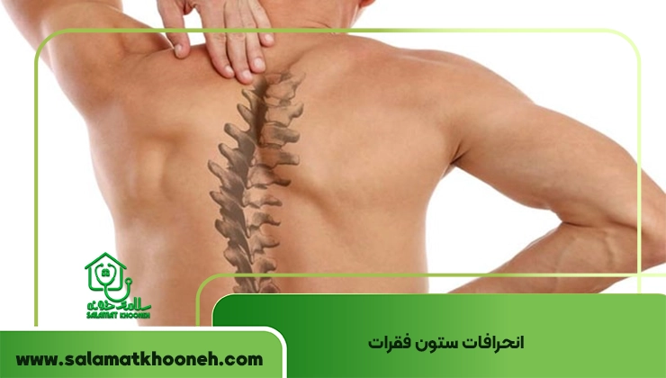 انحراف ستون فقرات