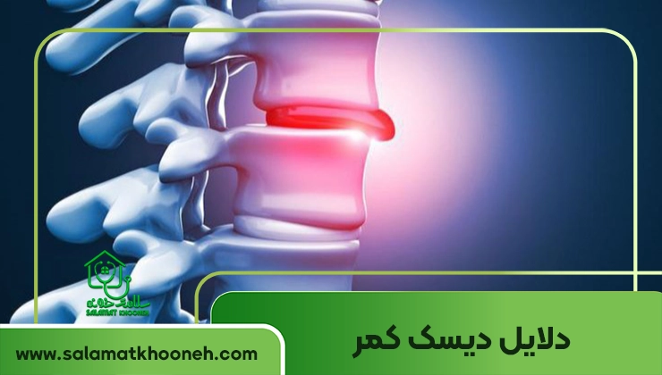 دلایل دیسک کمر