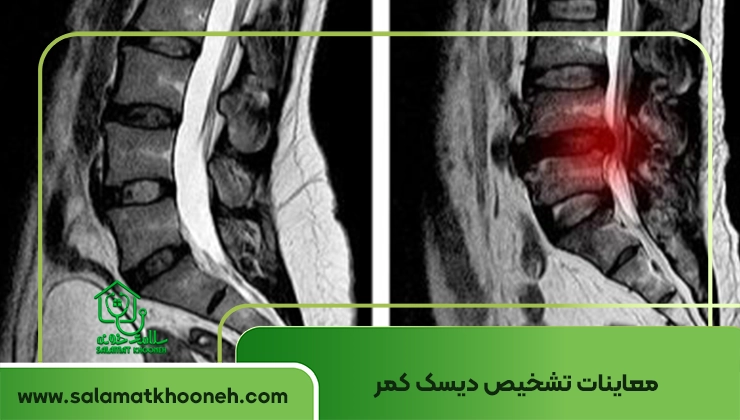 lumbar disc