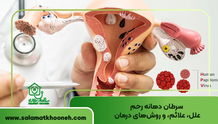 سرطان دهانه رحم
