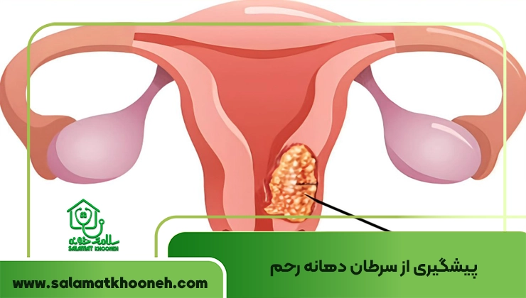 پیشگیری از سرطان دهانه رحم