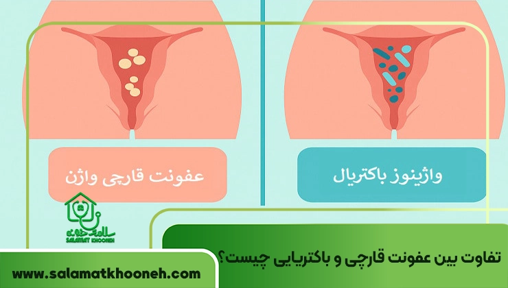 تفاوت بین عفونت قارچی و باکتریایی