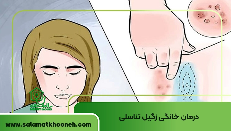 درمان خانگی زگیل تناسلی