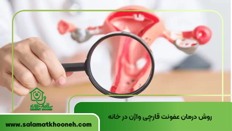 درمان عفونت قارچی واژن در خانه