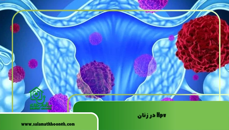 Hpv در زنان