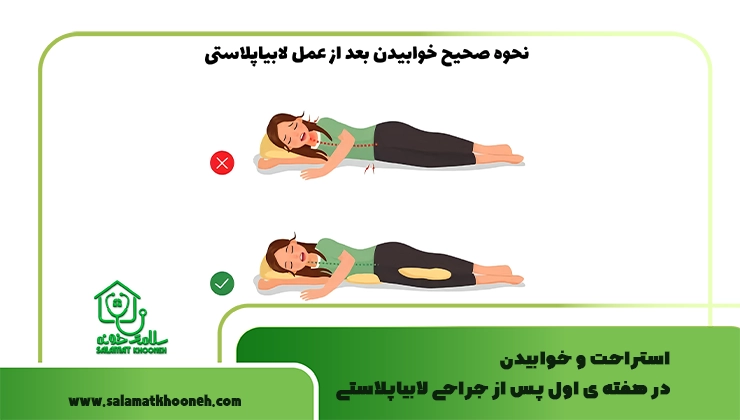 استراحت و خوابیدن در هفته‌ ی اول پس از جراحی لابیاپلاستی