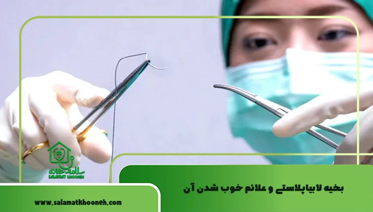 بخیه لابیاپلاستی و علائم خوب شدن آن