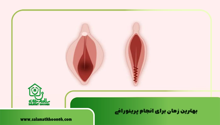 بهترین زمان برای انجام پرینورافی