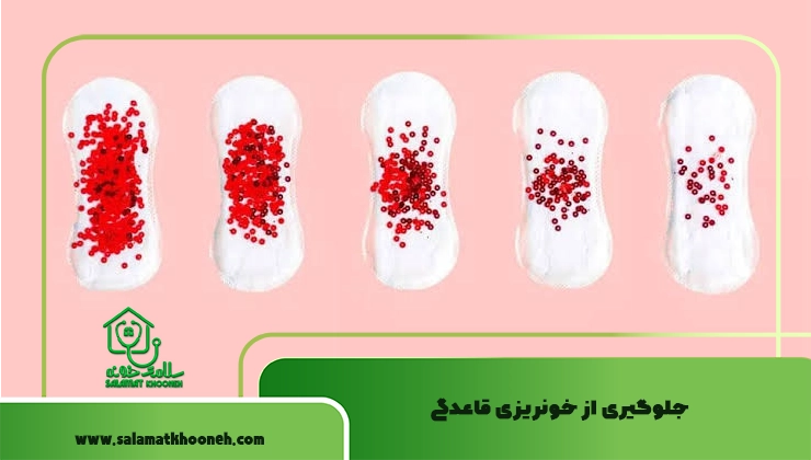 جلوگیری از خونریزی قاعدگی