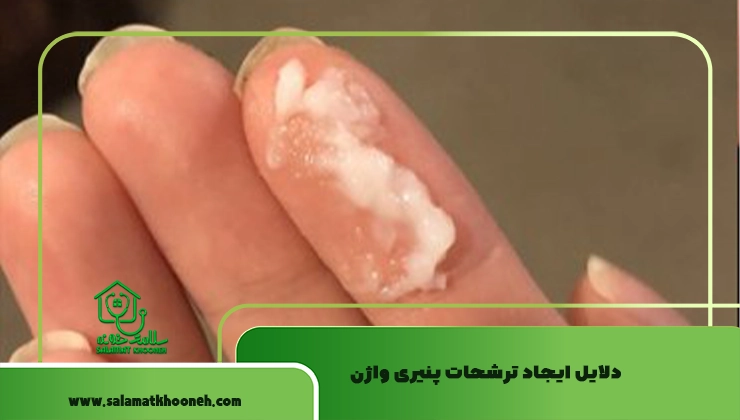 عفونت واژن پنیری