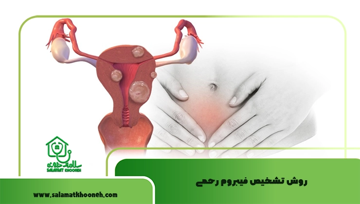 روش تشخیص فیبروم رحمی