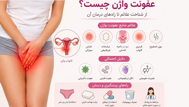 عفونت واژن