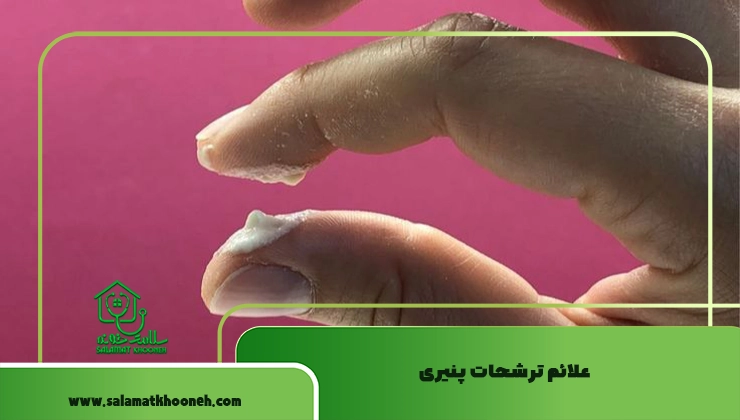 علائم ترشحات پنیری