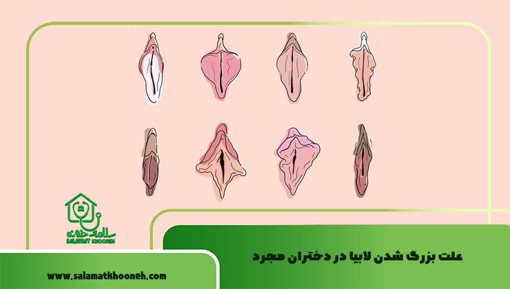علت بزرگ شدن لابیا در دختران مجرد