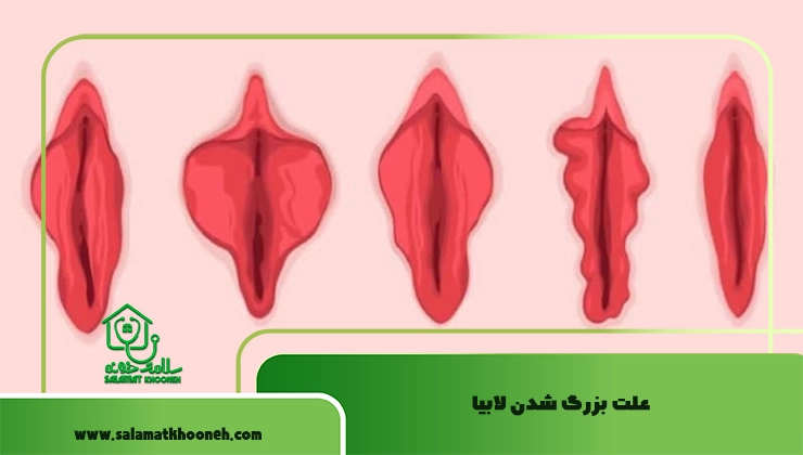 علت بزرگ شدن لابیا