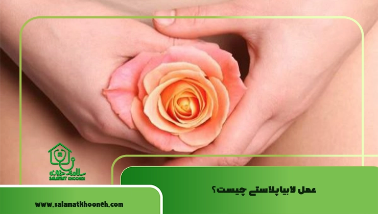 عمل لابیاپلاستی چیست