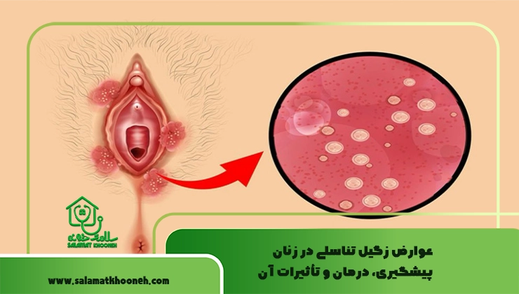 عوارض زگیل تناسلی در زنان