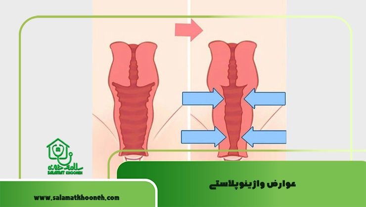 عوارض واژینوپلاستی