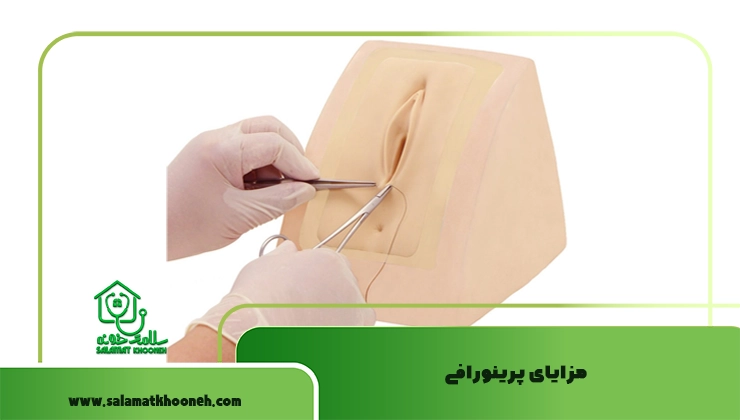 مزایای پرینورافی