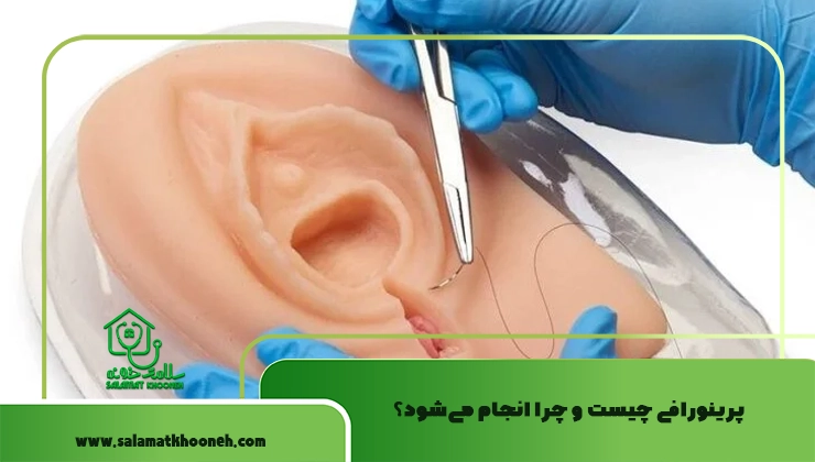 پرینورافی