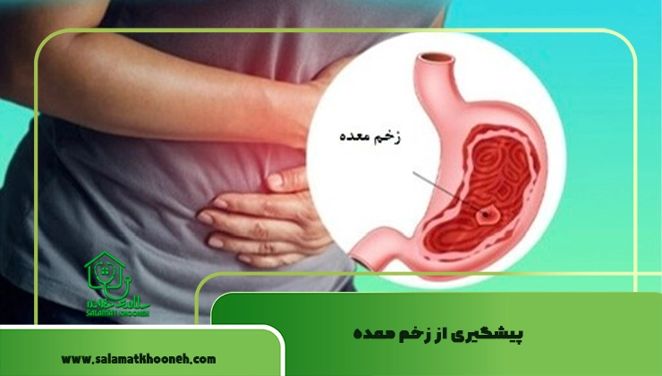 پیشگیری از زخم معده