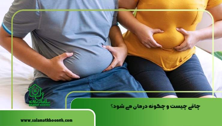 چاقی چیست