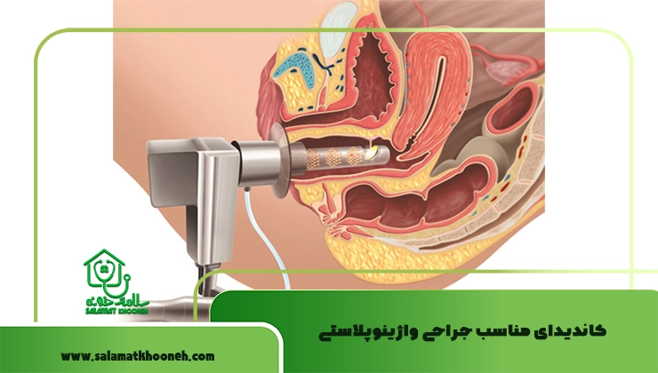 جراحی واژینوپلاستی