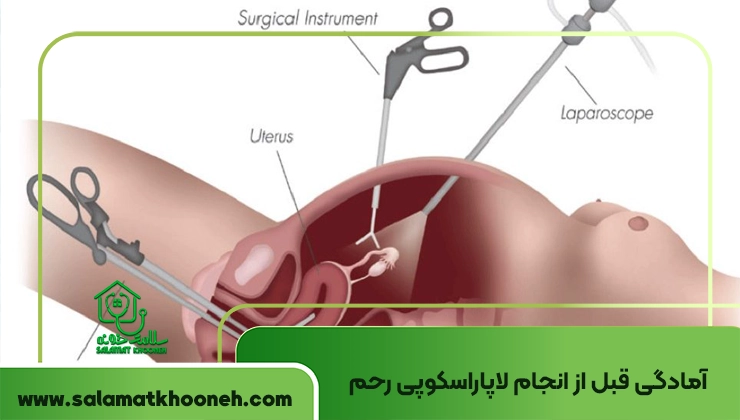 آمادگی قبل از انجام لاپاراسکوپی رحم