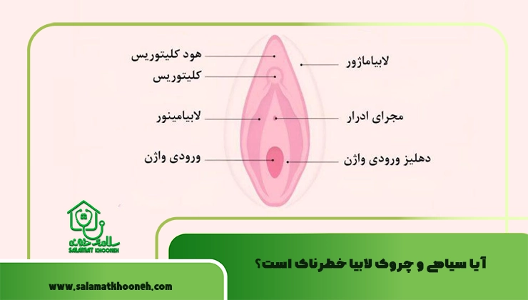 آیا سیاهی و چروک لابیا خطرناک است؟