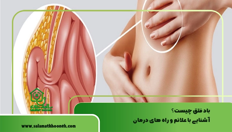 باد فتق