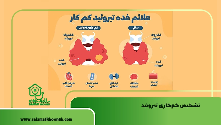 تشخیص کم‌کاری تیروئید