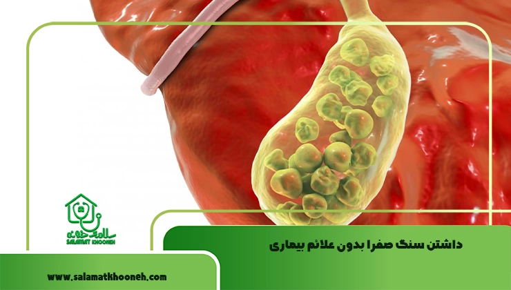سنگ صفرا بدون علائم
