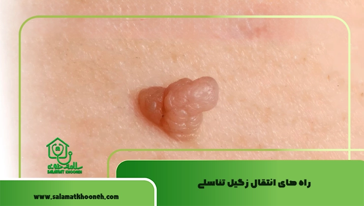 راه های انتقال زگیل تناسلی