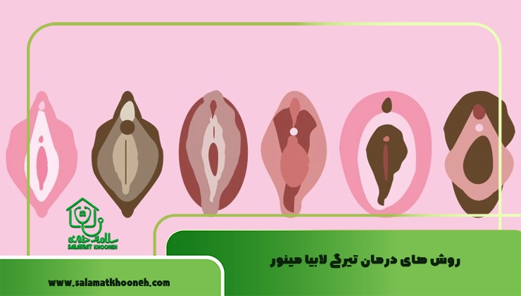 روش ‌های درمان تیرگی لابیا مینور