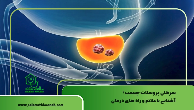 سرطان پروستات