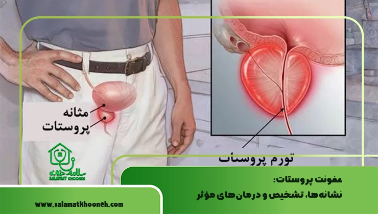 عفونت پروستات