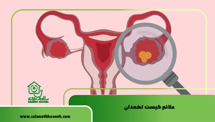 علائم کیست تخمدان