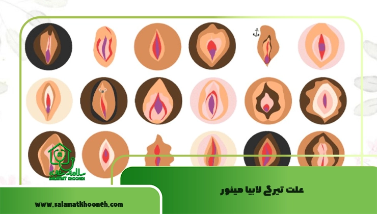 علت تیرگی لابیا مینور