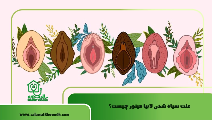 علت سیاه شدن لابیا مینور چیست؟
