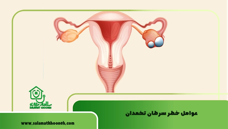 عوامل خطر سرطان تخمدان