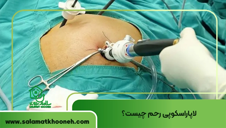 لاپاراسکوپی رحم