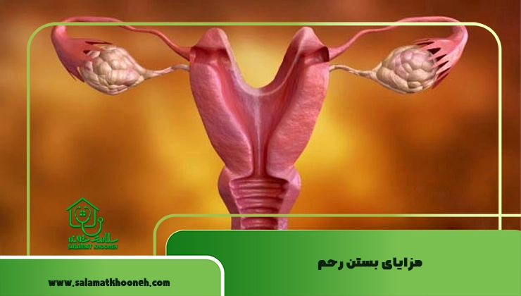 مزایای بستن رحم