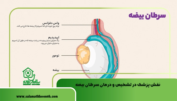 درمان سرطان بیضه