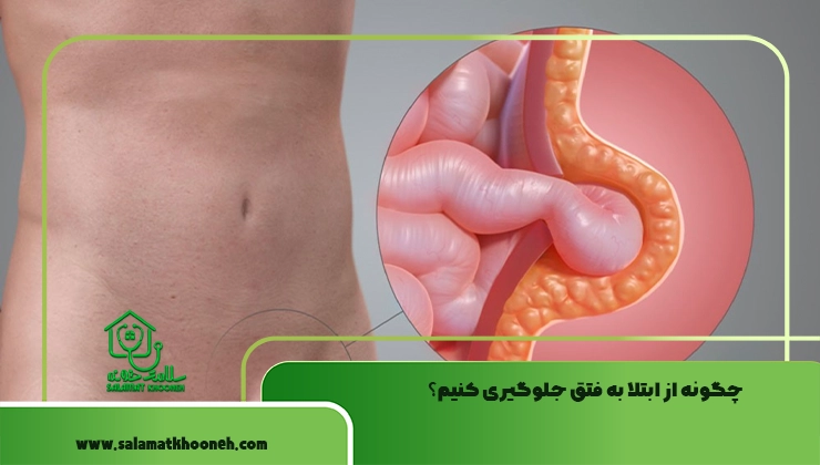 علائم بیماری فتق