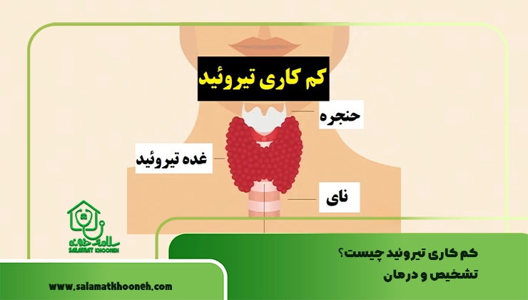 کم کاری تیروئید