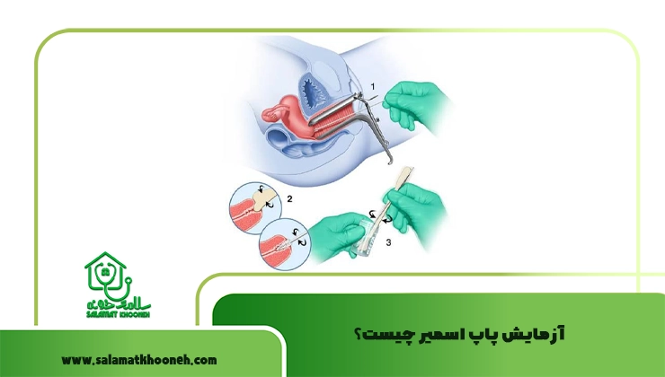 آزمایش پاپ اسمیر
