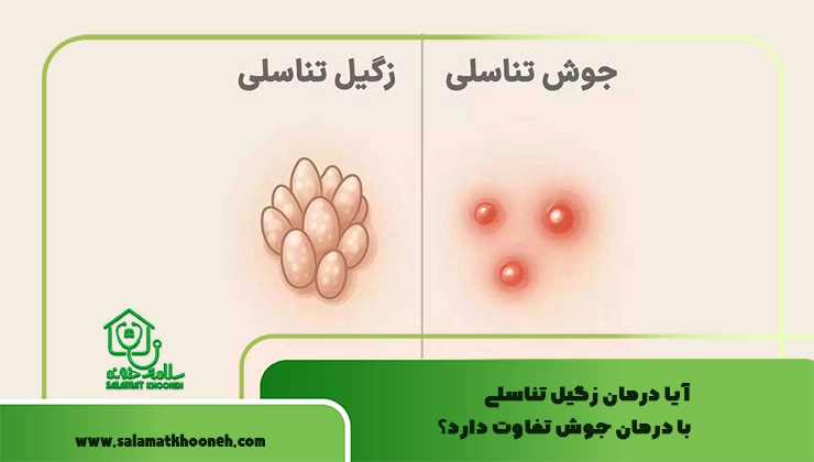 آیا درمان زگیل تناسلی با درمان جوش تفاوت دارد؟